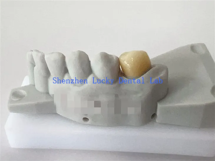 Impression 3D Chine Curcony Zirconia Crown Factory personnalisée