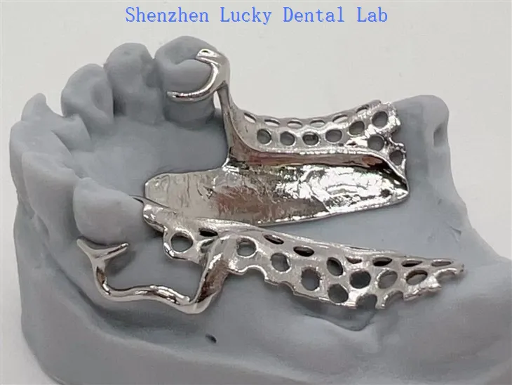 Impression 3D China Dental Cocr Metal Framework