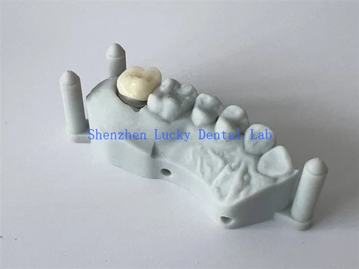 Chine 3D Print Dental All Ceramic Zirconia Crown Factory