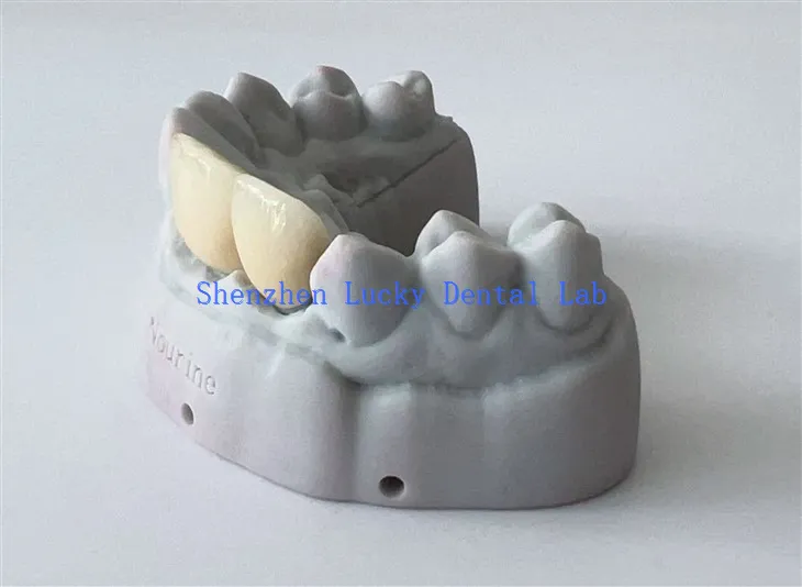 Chine 3D Print Dental PFM COCR CRONK