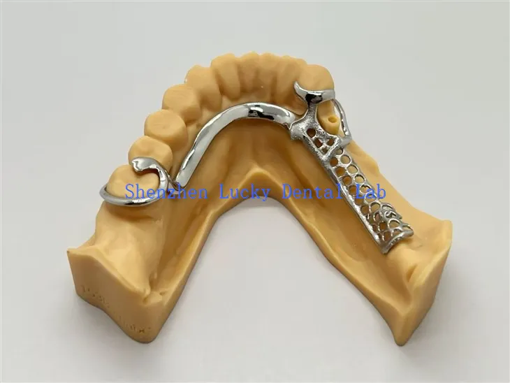 Cadres Cobalt Chrome