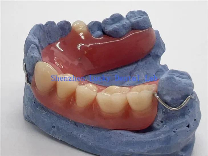 Prothèse en acrylique partielle confortable avec fermoir à fil