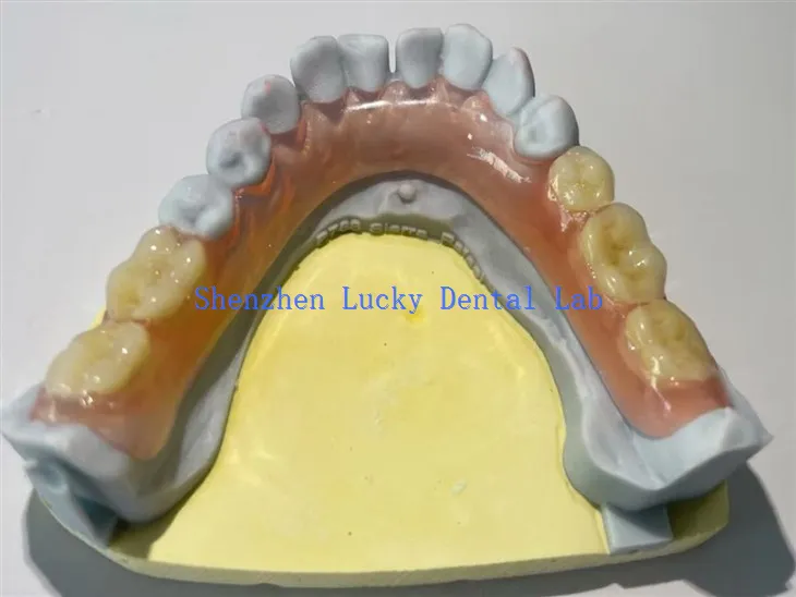 Fabricants dentaires flexibles partiels confortables