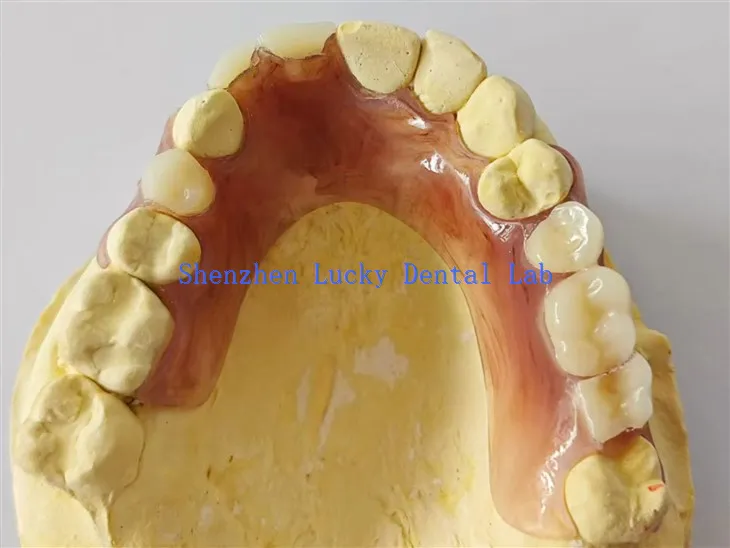 Denture flexible partielle dentaire foncé fabriquée en Chine