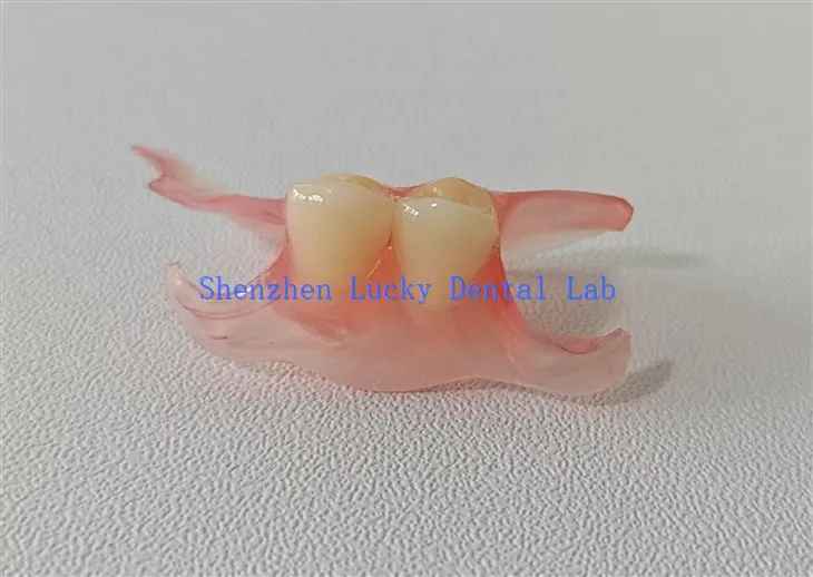 Denture flexible partielle dentaire avec laboratoire dentaire à fermoir valplast