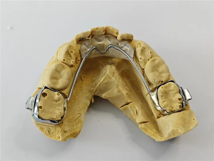 Plan de morsure antérieure dentaire