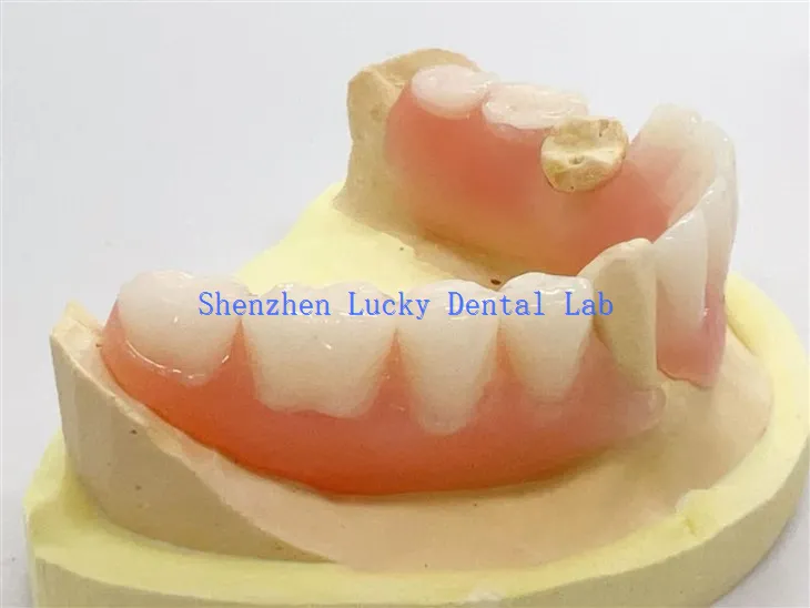 Prothèse flexible partielle dentaire de haute qualité