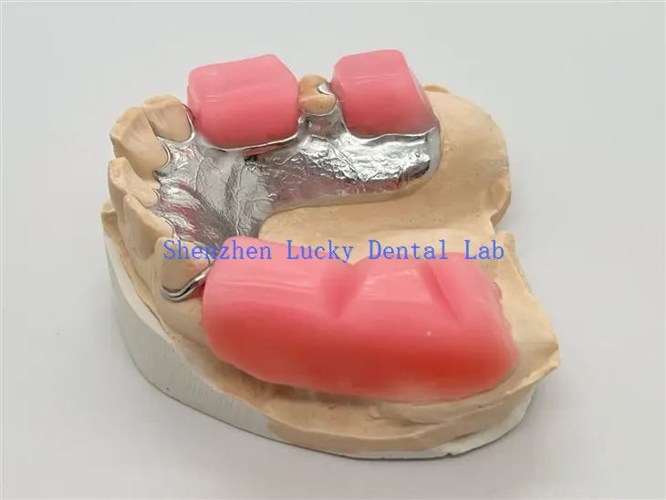 Cadre en métal avec bloc de morsure