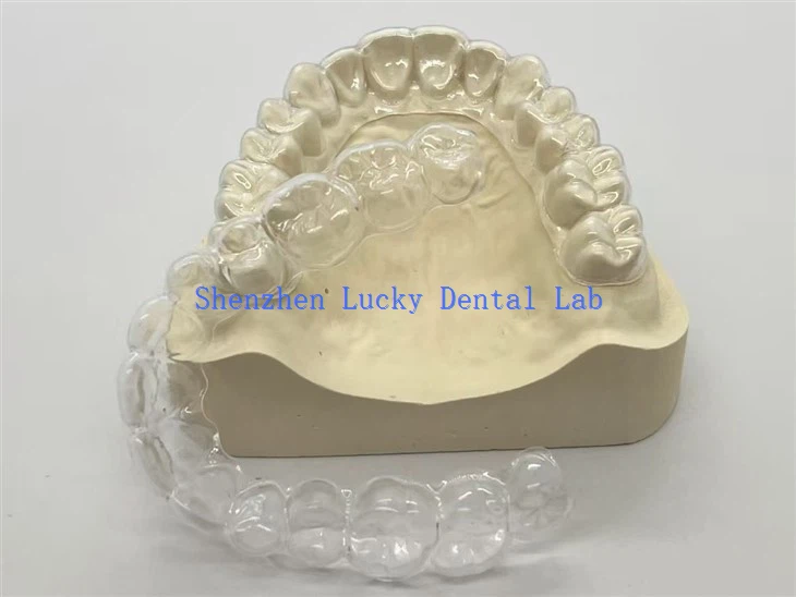 Professionnel Clear Retenue