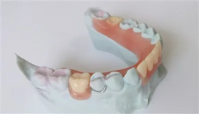 Princer en acrylique partielle dentaire 3D avec fermoir à fil