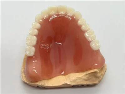 Prothèse acrylique complète avec gomme Meharry